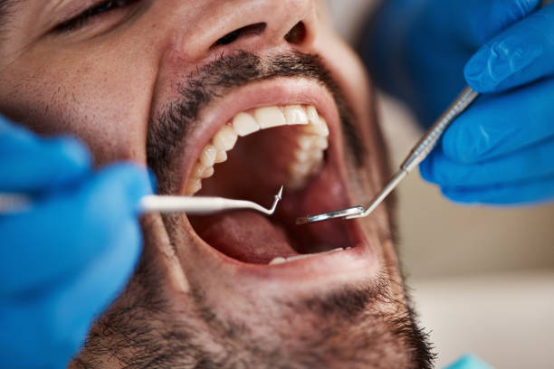 Best Full Mouth Reconstruction  in Newcastle, OK